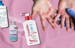 Atopik ciltler için en iyi kremler hangisi? Dermatolog önerisiyle atopik cilt için 3 krem