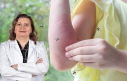 Böcek ısırıkları ve sokmalarında ölüm riski! İlk 20 saniye kritik