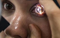Göz sağlığı için bu alışkanlıklara dikkat! Doğrudan retinaya zarar veriyor