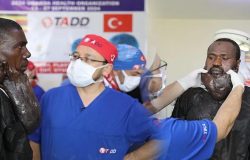 Sakaldan da uzundu! Yüzündeki kitleden Türk doktorları kurtardı!