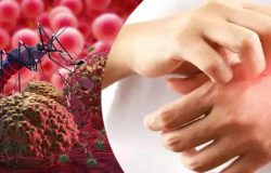 Seyahat edenler dikkat! Yüksek ateşle başlıyor ölüme neden olan tehlike: Sıtma
