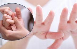 Tırnaklardaki bu belirtilere dikkat: Kansere hatta ölüme neden olabilir!
