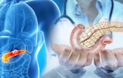 Ünlü doktor pankreas kanseri riskini artıran besinleri açıkladı: DNA hasarına neden oluyor